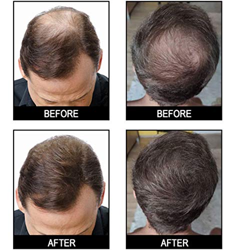 Фибри За коса Влакна За Удължаване на косата с Необнаруживаемые Косата По-Гъста За Изтъняване на Косата на