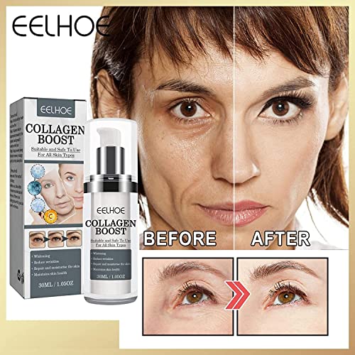 EELHOE Collagen Boost Серум против Стареене, EELHOE Серум против Стареене, Eelhoe Collagen Boost Стареене Серум Против бръчки Серум за корекция на кожни дефекти (2 бр.)