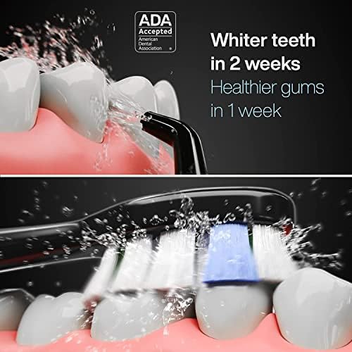 AquaSonic Home Dental Center PRO – Почистване на зъбите и да се насладите на конец за зъби е по-лесно просто – Четка и мулине – Мощна четка за зъби и вода конец – По-бели зъби и здр